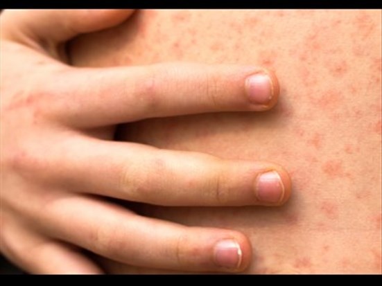 Les autorités appellent à la prudence durant la période des Fêtes